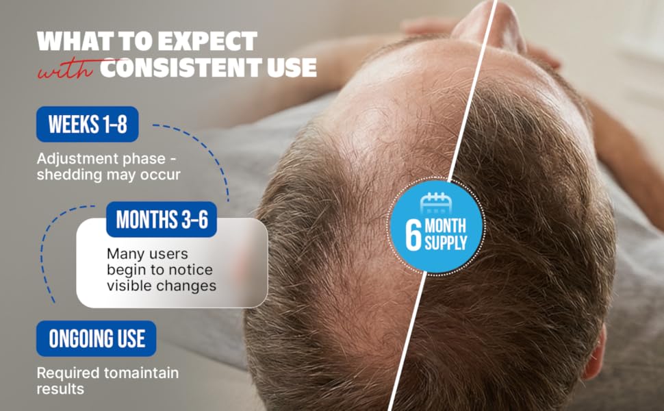 Minoxidil Hair Growth Treatment