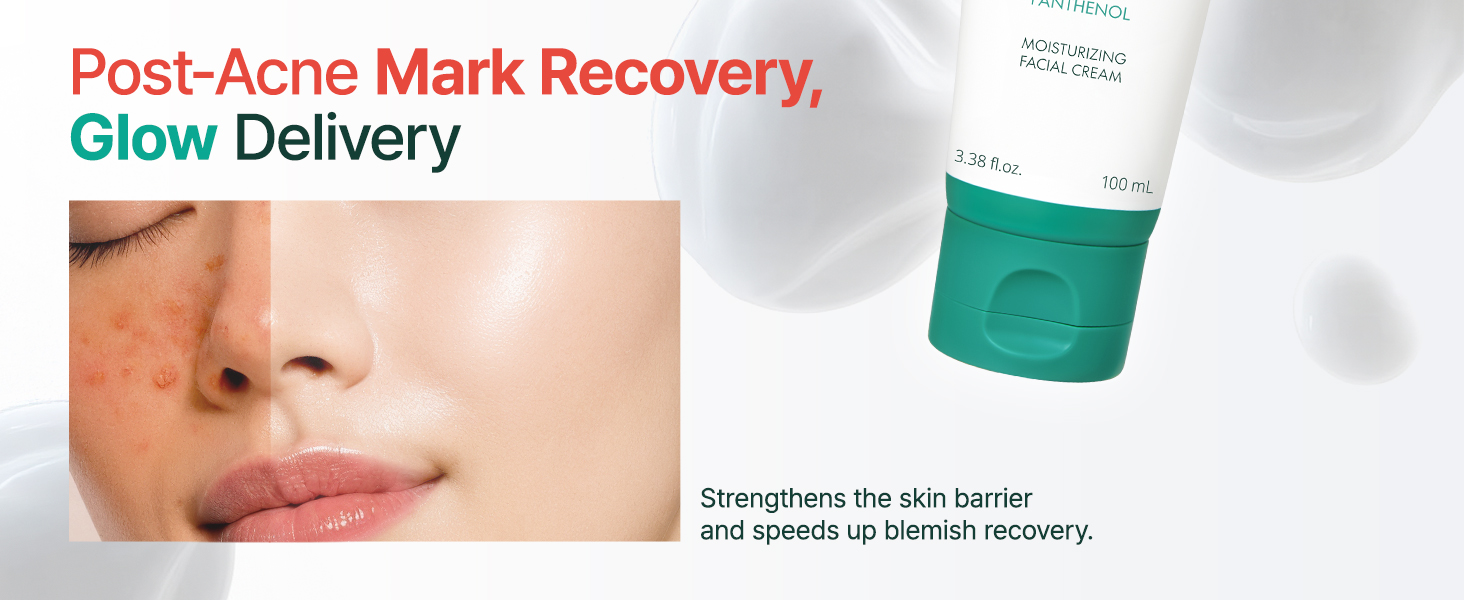 korean skin care, skin moisturizer, korean moisturizer, blemish skin care